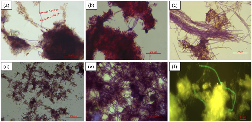Microscopic view of activated sludge floc and filamentous bacteria